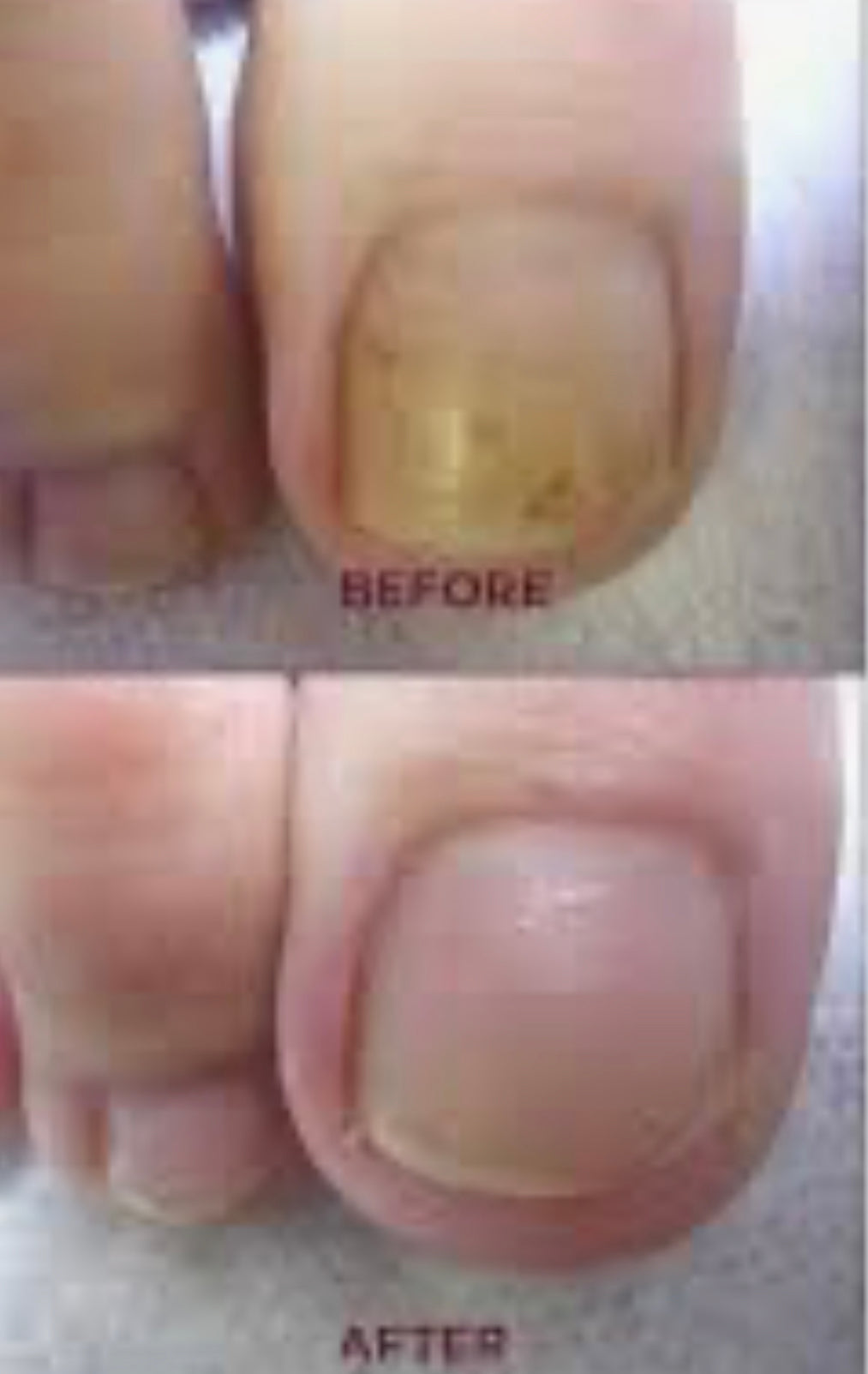 Topical: Bye Bye Fungi