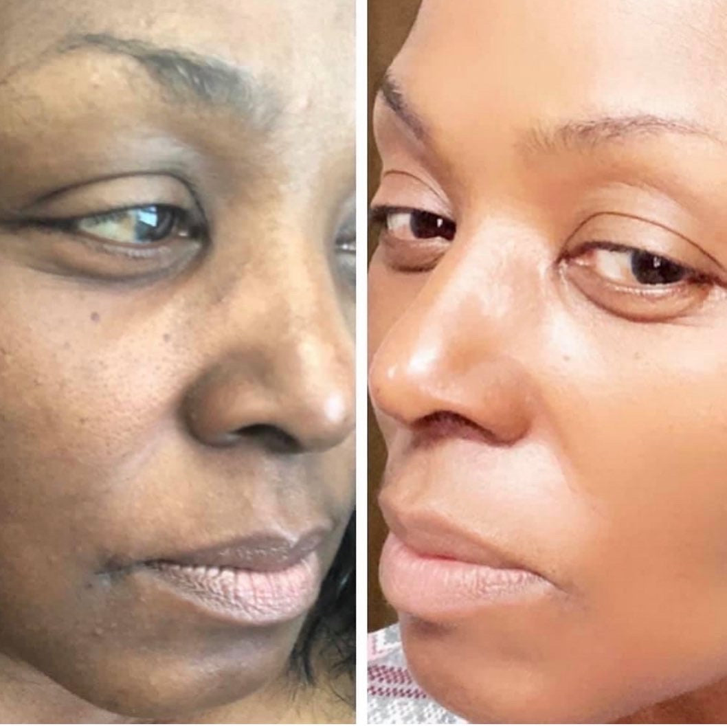 Exfoliate: AFTERGLOW | Complexion Correction Exfoliate